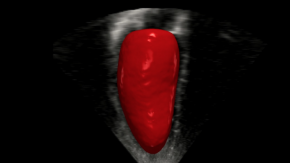 NVIDIA Clara醫療計算平臺講堂（1）| 如何快速上手？